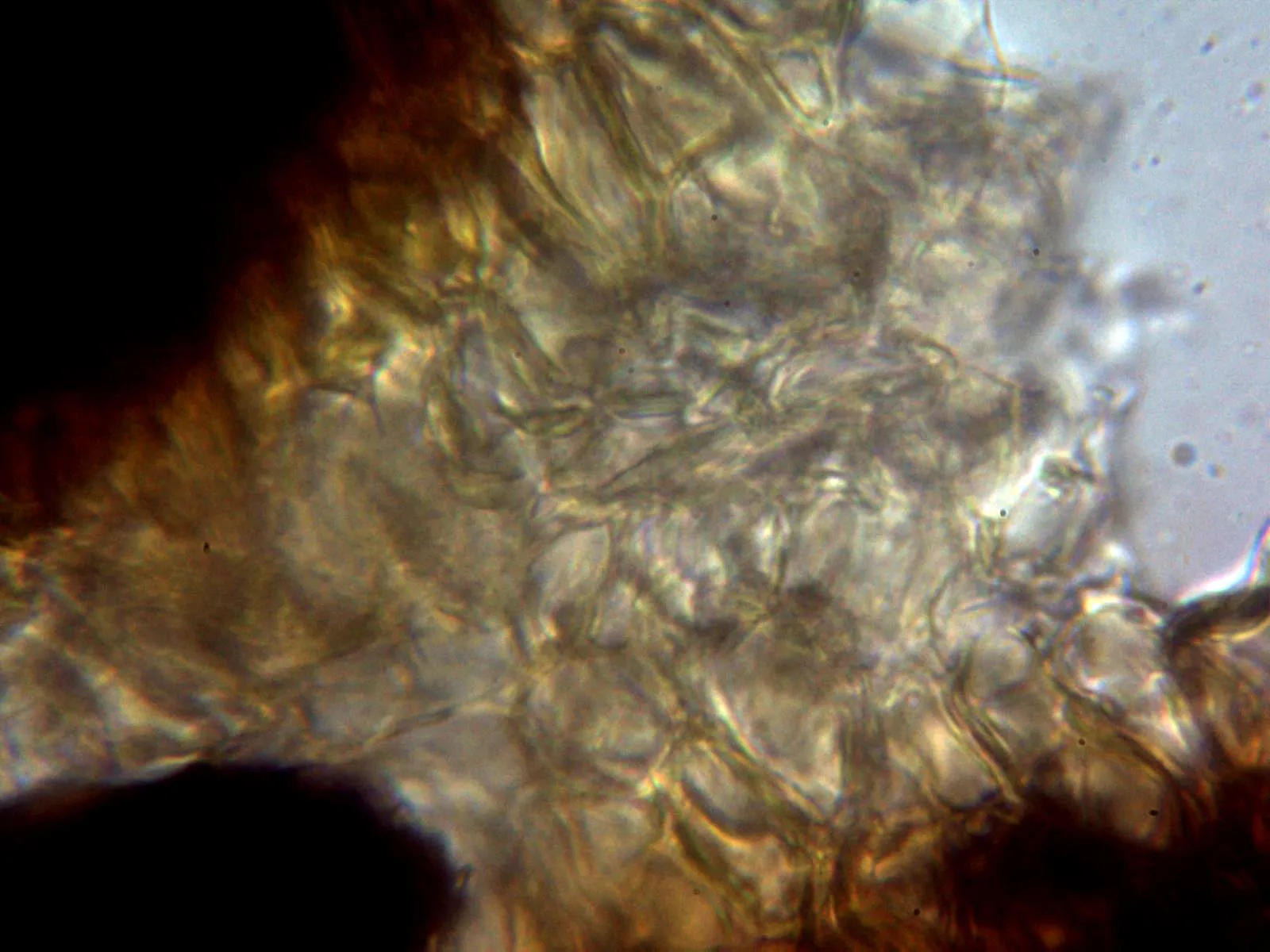 Microscopía de Tuber mesentericum - 10 - Peridio interno